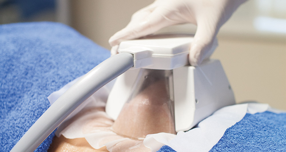 Multiple Areas in One Session HIFU and Fat Freezing Wentworth