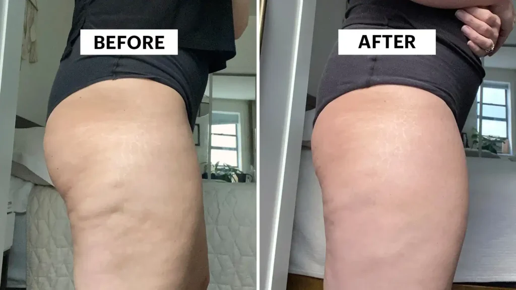 Do Toning Exercise Wentworth Really Tackle Cellulite?