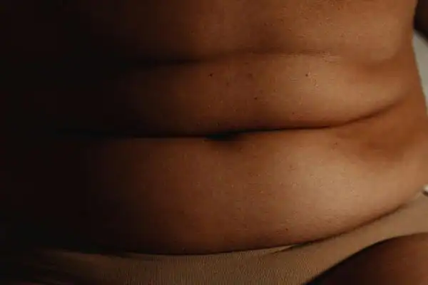 image of what stress can do on the stomach area and how Lipo 360 Wentworth can help to change your body shape.
