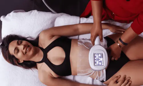 Woman having Body Sculpting treatment post injury Wentworth